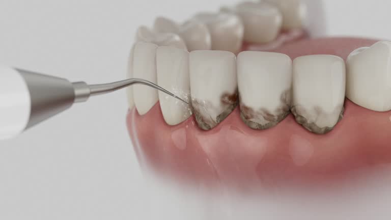 Reliable Dental contractor in Hayward, CA by Smile Center Dentistry